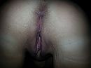 my butthole, photo 3264x2448, 1 comments, 1 votes